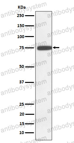 Anti-GNE Antibody (R2P64)