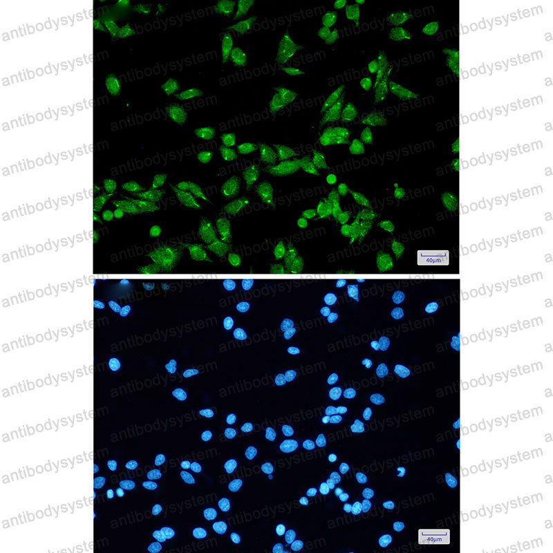 Anti-PRPF31 Antibody (R2P67)