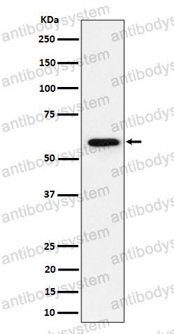 Anti-PRPF31 Antibody (R2P66)