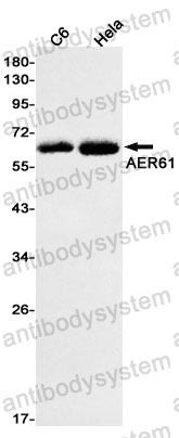 Anti-EOGT Antibody (R2P69)