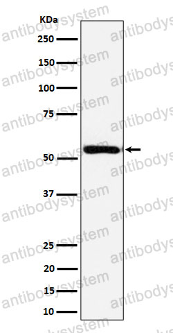 Anti-EOGT Antibody (R2P68)