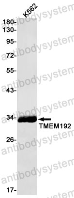 Anti-TMEM192 Antibody (R2P71)