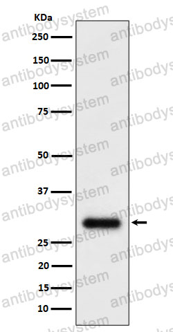 Anti-TMEM192 Antibody (R2P70)