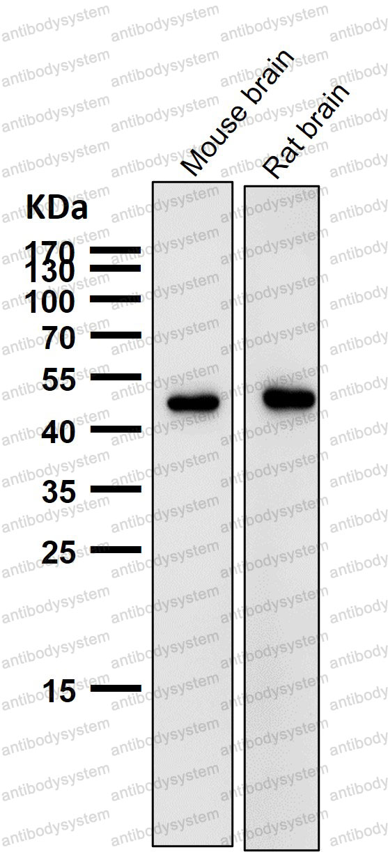 Anti-AZI2 Antibody (R2P74)