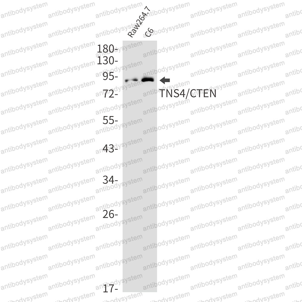 Anti-TNS4 Antibody (R2P77)