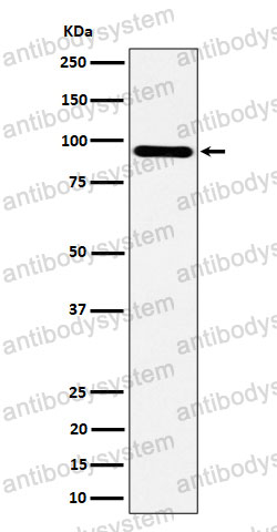 Anti-TNS4 Antibody (R2P76)