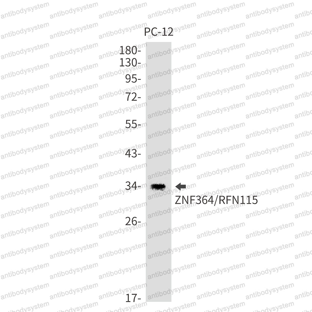 Anti-RNF115 Antibody (R2P79)