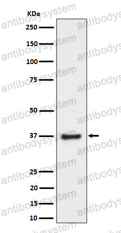 Anti-RNF115 Antibody (R2P78)