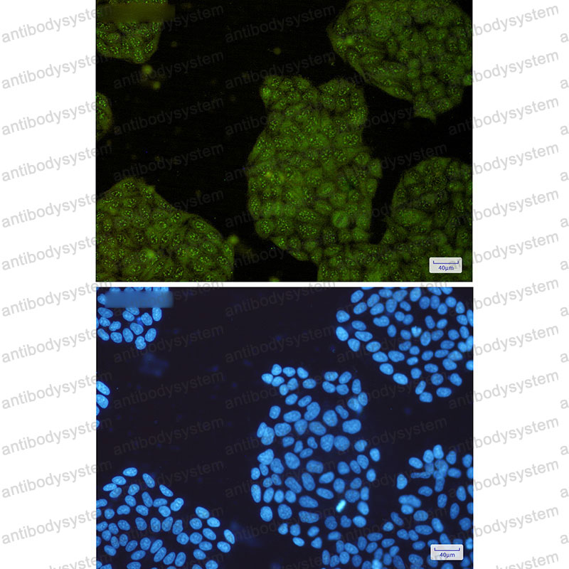 Anti-UFC1 Antibody (R2P82)