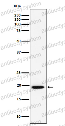 Anti-UFC1 Antibody (R2P80)