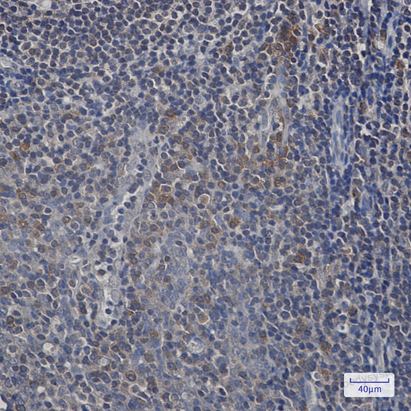 Anti-UFC1 Antibody (R2P81)