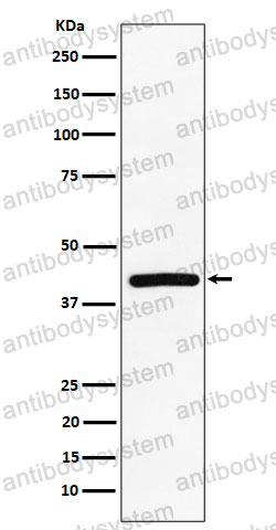 Anti-TMEM43 Antibody (R2P83)