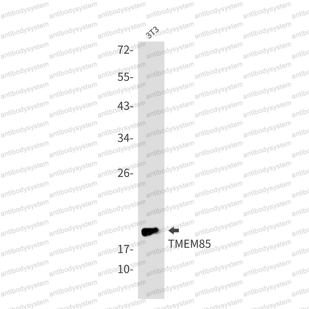 Anti-EMC4 Antibody (R2P86)
