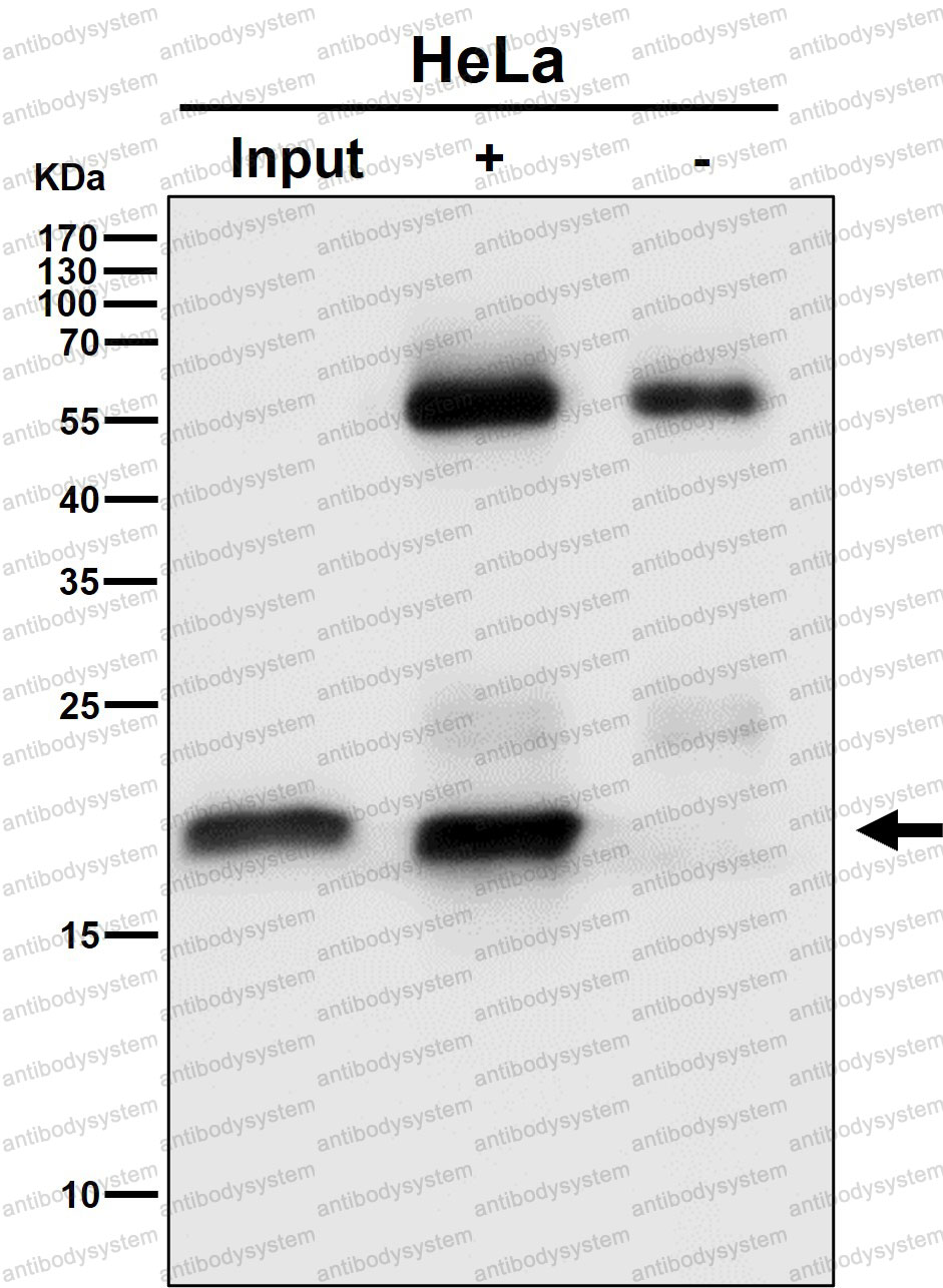 Anti-EMC4 Antibody (R2P85)
