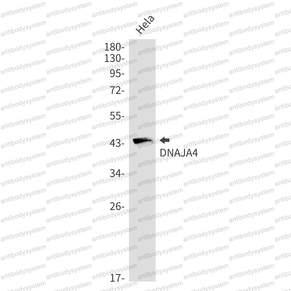 Anti-DNAJA4 Antibody (R2P88)