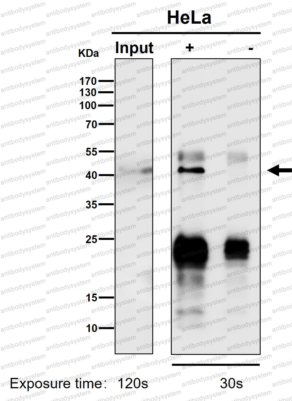 Anti-DNAJA4 Antibody (R2P87)