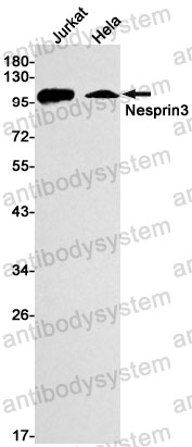 Anti-SYNE3 Antibody (R2P91)