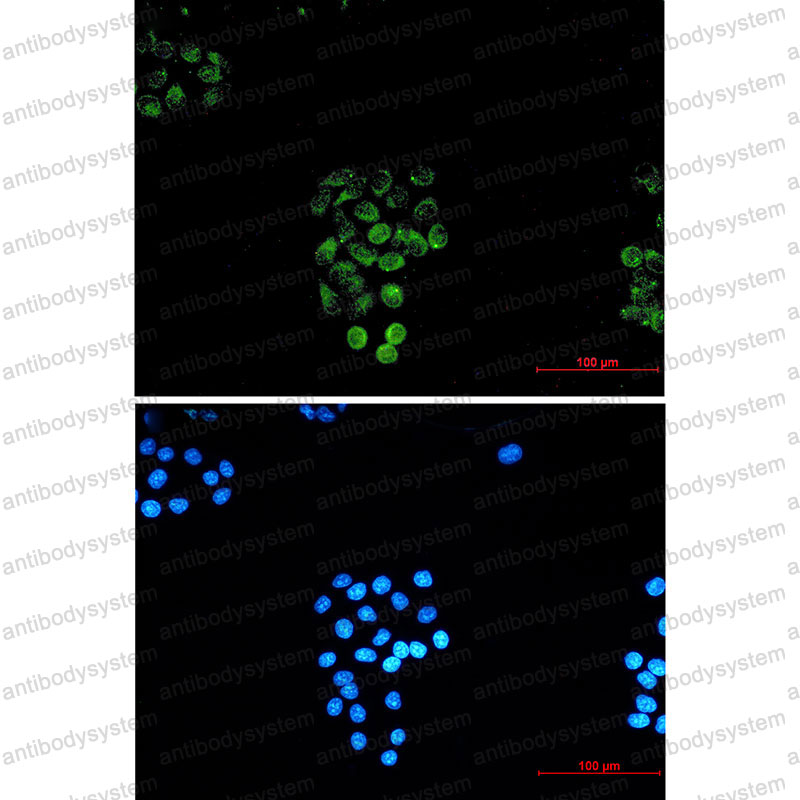 Anti-RASEF Antibody (R2P95)