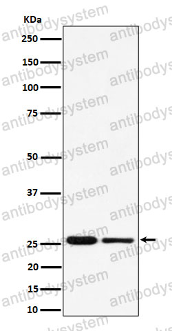 Anti-PMF1 Antibody (R2P96)