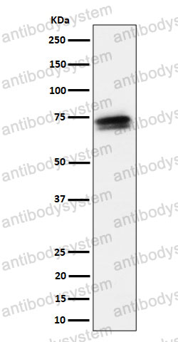 Anti-SSX2IP Antibody (R2P98)