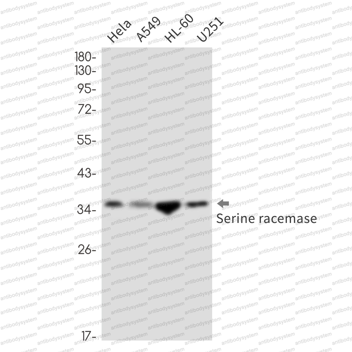 Anti-SRR Antibody (R2Q02)