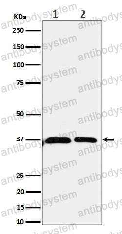 Anti-SRR Antibody (R2Q01)