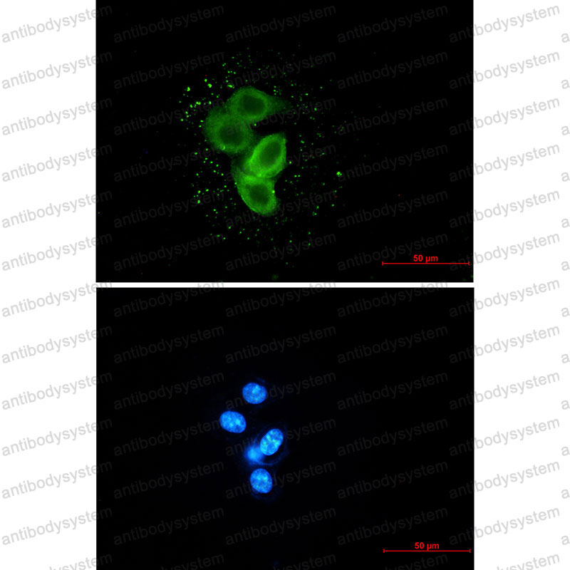 Anti-TMEM67 Antibody (R2Q04)