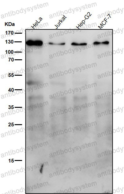 Anti-TMEM67 Antibody (R2Q03)