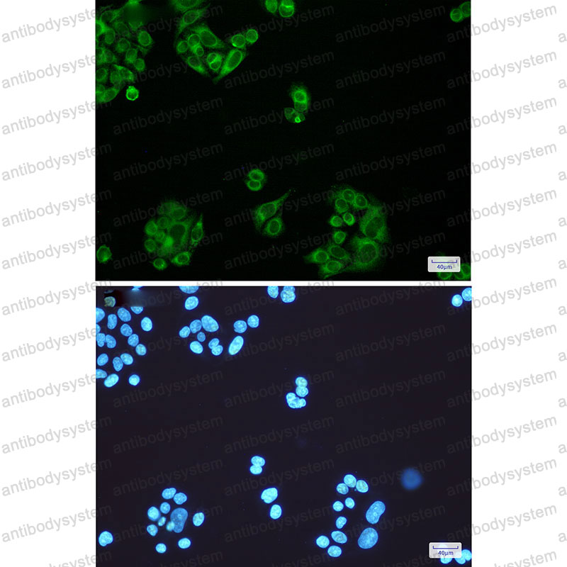 Anti-ELOVL5 Antibody (R2Q06)