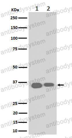 Anti-ELOVL5 Antibody (R2Q05)
