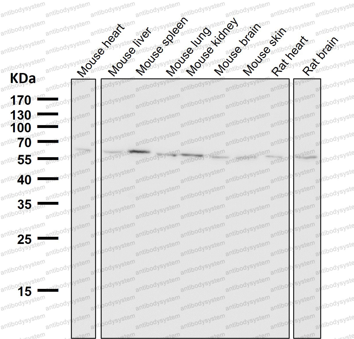 Anti-HRPT2/CDC73 Antibody (R2Q07)