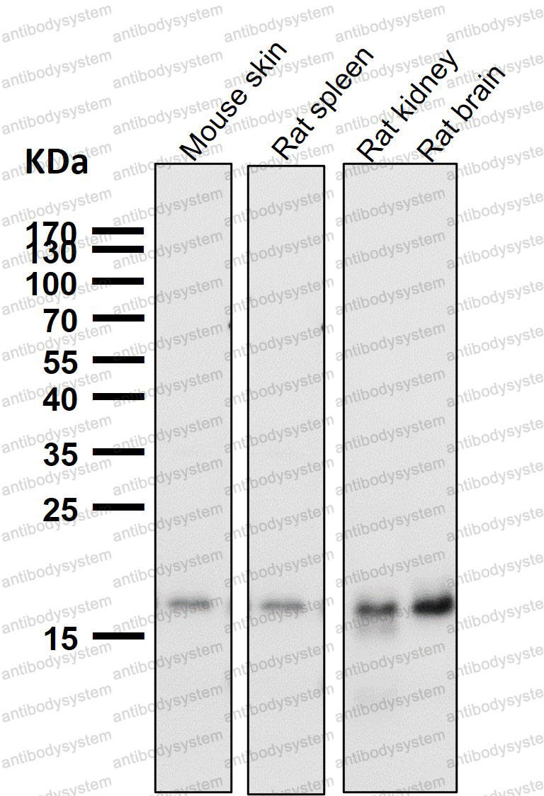 Anti-TIMM22 Antibody (R2Q09)