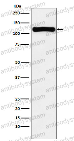 Anti-VPS11 Antibody (R2Q10)