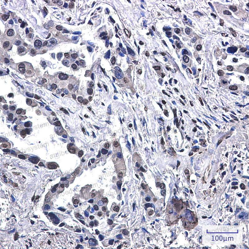 Anti-VPS35 Antibody (R2Q13)