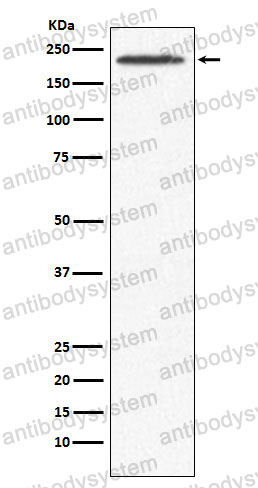 Anti-SMCHD1 Antibody (R2Q14)