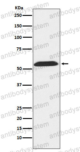 Anti-TXNRD2 Antibody (R2Q17)