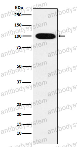 Anti-VPS18 Antibody (R2Q24)