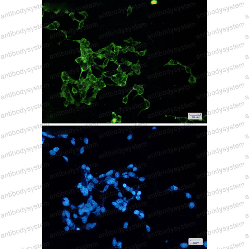 Anti-WNT2B Antibody (R2Q26)
