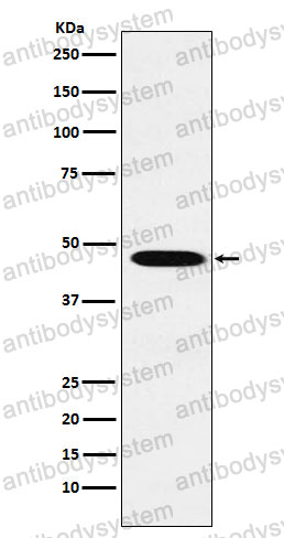 Anti-WNT2B Antibody (R2Q25)