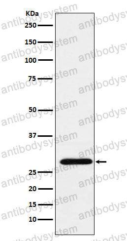 Anti-RGS18 Antibody (R2Q27)