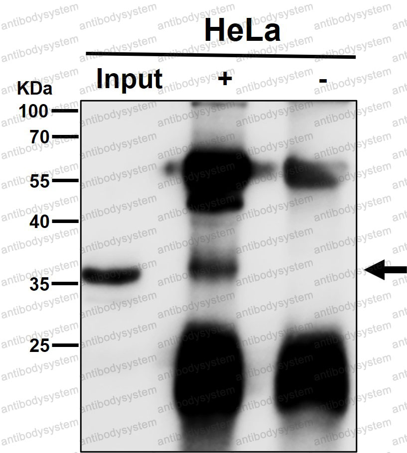 Anti-COPS5 Antibody (R2Q28)
