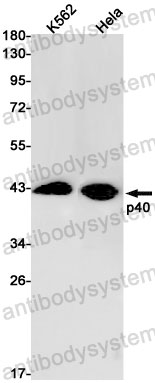 Anti-RABEPK/p40 Antibody (R2Q30)