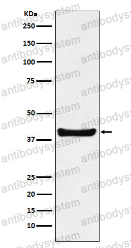 Anti-RABEPK/p40 Antibody (R2Q29)