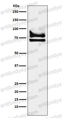 Anti-DDX17 Antibody (R2Q31)
