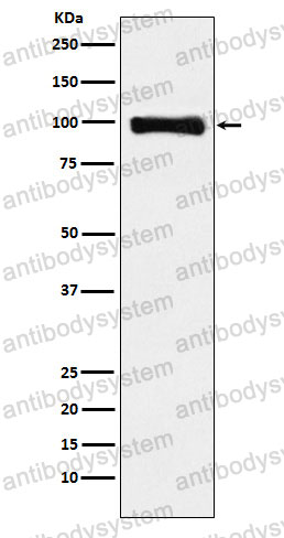 Anti-PIWIL1 Antibody (R2Q33)