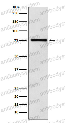 Anti-DCP1A Antibody (R2Q34)