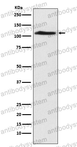 Anti-CHD1L Antibody (R2Q36)