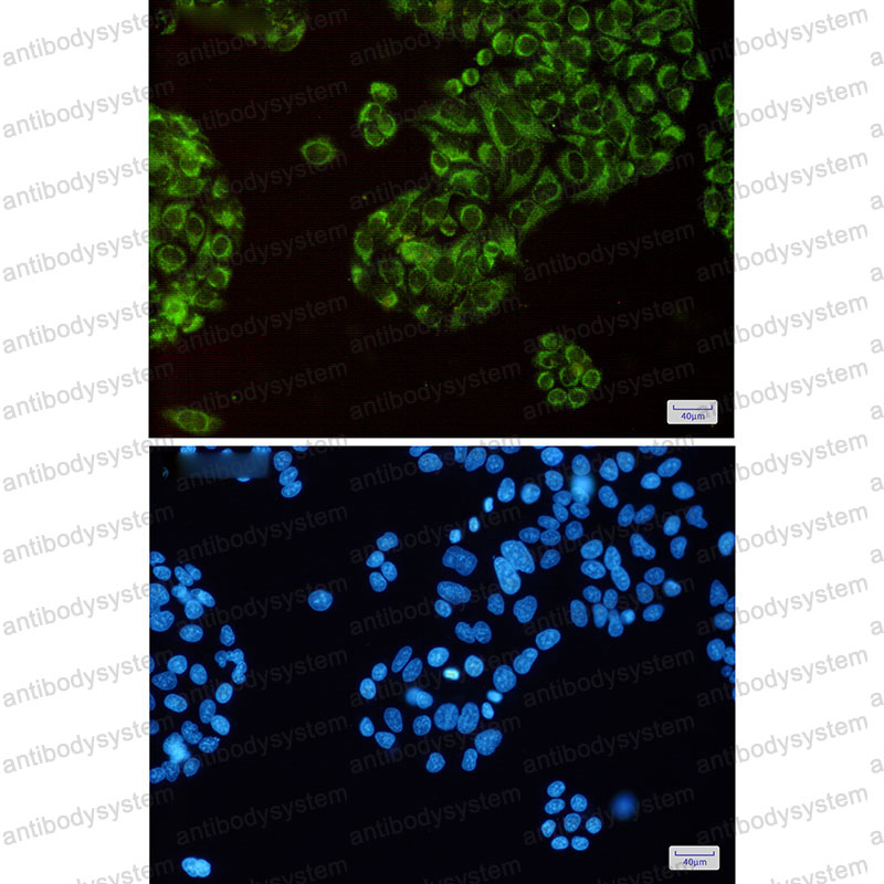 Anti-TXN2 Antibody (R2Q38)