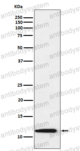 Anti-TXN2 Antibody (R2Q37)
