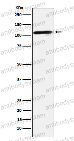 Anti-RAPGEF4 Antibody (R2Q39)
